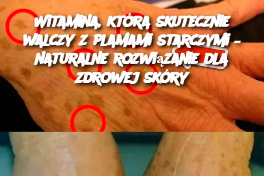 Witamina, która skutecznie walczy z plamami starczymi – naturalne rozwiązanie dla zdrowej skóry